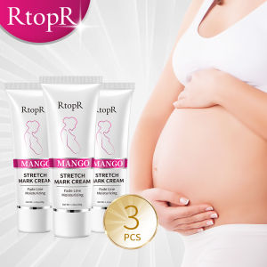 RtopR 3PCS Mango Remove Stretch Marks Cream Anti-Aging Anti-Winkles Maternity Skin Repair Remove Pregnancy Scars Body Skin Care 40g