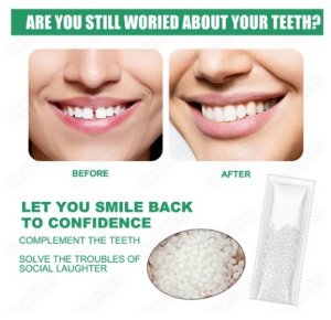 Dental Restoration Gel Safe and nontoxic Solid Gutta Percha Thermal Beads Temporary Teeth Resin False Teeth Temporary Tooth Repair Set Vampire Teeth Glue Solid Glue10g