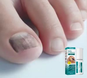 South Moon Toenail Repair Solution Smooth Nails Hand and Foot Nail Cleaning Nutritional Repair Solution