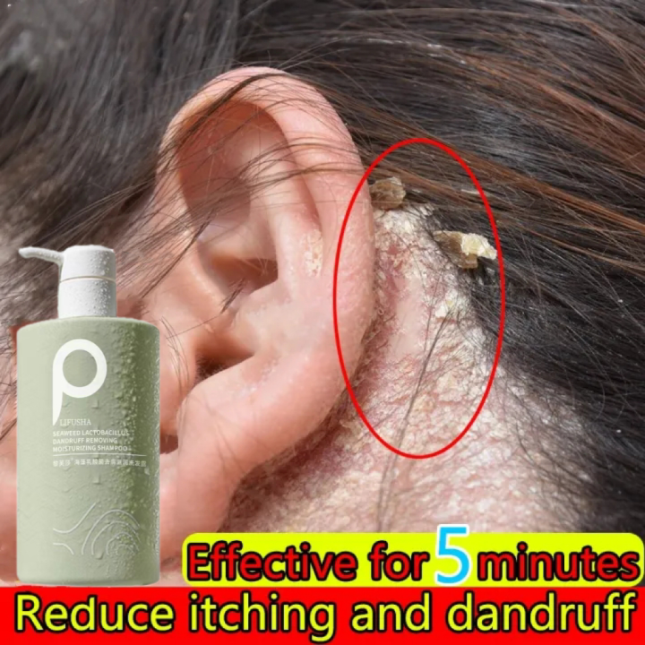 Sea Salt AntiDandruff Shampoo Deep cleaning, get rid of dandruff, anti