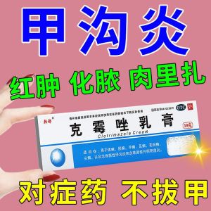 甲沟炎用甲沟感染发炎红肿化脓脚指甲长肉里消肿止痛克霉唑乳膏