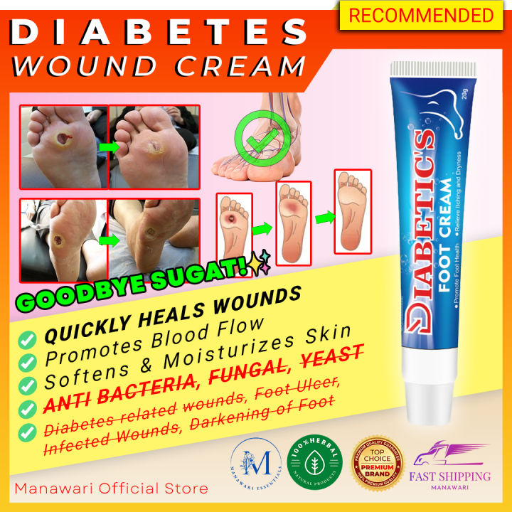 Sumifun Diabetic Wound Ointment Diabetic Foot Cream Treatment Wounds Healing Cream Gamot Sa