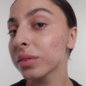 The INKEY List SuperSolutions 1% Retinol Serum for Face and Neck Helps with Scar Wrinkle and Skin Tone Appearance for Healthy-Looking Skin 1.01 fl oz
