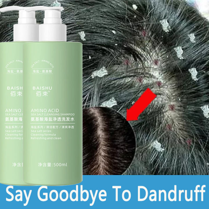 Original Sea Salt Shampoo Anti Dandruff Shampoo Psoriasis Shampoo For