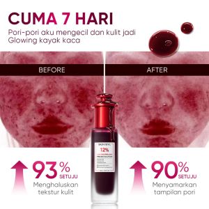 SKINTIFIC  MSH Niacinamide Brightening Moisturizer Gel 30g - Brightens skin / Moisturizes / Tightens skin