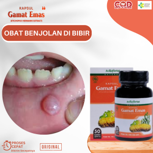 Obat Benjolan Di Bibir Mulut Obat Benjolan Di Mulut Obat Penyakit Mucokel Obat Benjolan Di Bibir Bagian Dalam Obat Benjolan Kelenjar Langit Mulut Obat Benjolan Yang Membesar Di Bibir Obat Benjolan Putih Di Bibir Degan Kapsul Gamat Emas