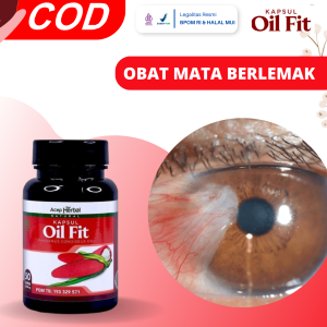 Obat Mata Berlemak Obat Menghilangkan Selaput Mata Obat Mata Pterygium Penghilang Mata Berselaput Obat Iritasi Mata Obat Mata Rabun Jauh Rabun Dekat Penglihatan Ganda Mata Klazion Dengan Oil Fit