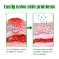 gamot sa kati kati sa balat skin fighter atoderma cream original ointments and creams eczema treatment dermacare cream for psoriasis skin deases antibacterial cream. 