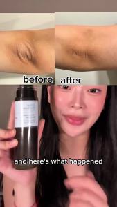 [Reday stock]MEDITHERAPY Retinal Skin Booster  Essence  –  Suitable for beginners to use  Non-irritating Retinol for Face and Body  –  Shrink pores  Anti-wrinkle Treatment  glass skin  –  Korean Skin Care 5.07  Fluid Ounce ( about  5.07  Ml )  Large S