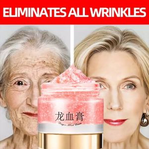 Dragon Blood Retinol Cream Whitening Moisturizing Melasma Remover Ance Freckles Remove 50g