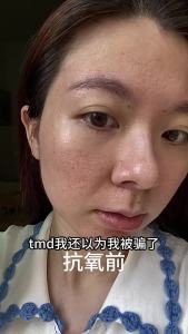 [30 years younger] Ginseng Gold Polypeptide Extract Anti-aging Lighten Fine Lines Moisturizing Facial Serum