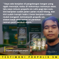 Obat Oles Pengempis Benjolan Di Kelopak Mata Bintitan dan Bintilan Kalazion Propolis SM Brazilian. 