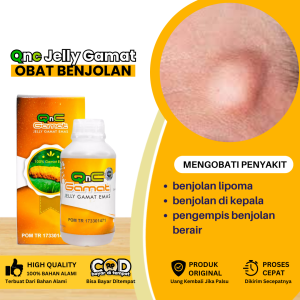 Obat Benjolan Obat Benjolan Lipoma Obat Benjolan Di Kepala Obat Penghilang Benjolan Di Belakang Telinga Obat Benjolan Di Leher Obat Mengempeskan Benjolan Berupa Cairan Obat Kelenjar Getah Bening Gondongan Dengan Qnc Jelly Gamat