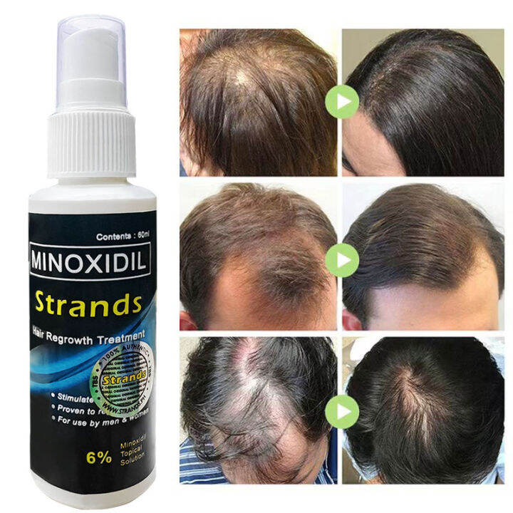 Minoxidil Strands 6% Hair Grower Beard Grower | Lazada PH