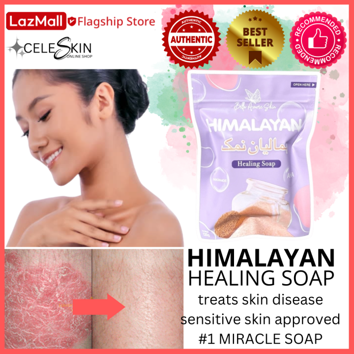 [ 🔥 🔥 Original HIMALAYAN HEALING SALT SOAP by Bella Amore ] treats eczema psoriasis blemishes