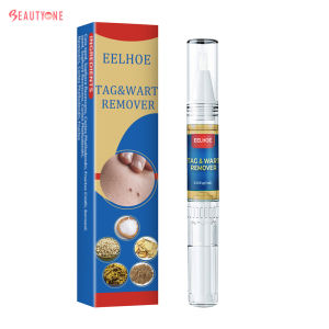 Warts Remover Original Kasoy Oil Warts Remover Warts And Skin Tags Remover Wart Ointment Warts Magic Remover Skin Tag Remover Skin Growth Mole And Warts Remover Wart Treatment ketuat remover