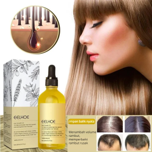 Minyak Penumbuh Rambut Botak Dengan Rosemary Alami Perawatan Kebotakan & Rambut Rontok Esensial Herbal Cepat Tumbuh Rambut