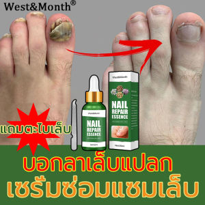 West&Month 30ml เซรั่มบำรุงเล็บ เล็บเท้าเล็บมือ บำรุงเล็บ (ซ่อมแซมเล็บ เล็บขบ ซ่อมเล็บ เชื้อราเล็บ) ดูแลเล็บ ปรับปรุงเล็บแข็งแรงและมีสุขภาพดีได้ใน 7วัน ครีมบำรุงเล็บ สำหรับปัญหาเล็บต่างๆ
