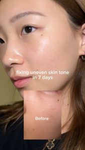 Serum Mediheal 40ml