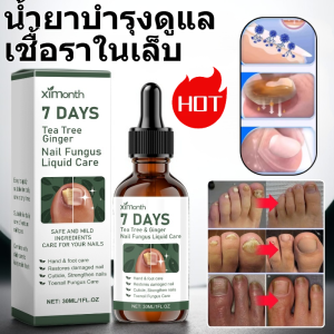 โซลูชั่นบํารุงเล็บสีเทา โซลูชั่นดูแลเล็บ ความปลอดภัย มีประสิทธิภาพ ปรับปรุงเล็บคุด ทําเล็บ โซลูชั่นดูแลเล็บสดใส บํารุงเล็บให้หนาขึ้น