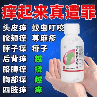 Calamine Lotion 100ml dermatitis and eczema lotion for relieving itching炉甘石洗剂100ml皮炎湿疹洗液止痒