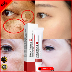 AUTHENTIC!! FRECKLE REMOVER WHITENING CREAM melasma removal cream original set pekas remover serum anti melasma