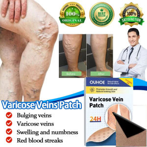 Miếng dán Thảo Dược Hỗ Trợ Giảm Giãn Tĩnh Mạch Chống Giãn Tĩnh Mạch Làm Dịu Chân