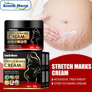 【Hot Sale】South Moon Pregnancy Repair Cream Stretch Mark Removal Removal Acne Scar Stretch Marks Cream Fat Striae Gravidarum Treatment Body Creams（30g）
