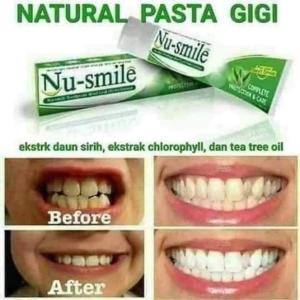 nu .smile odol gigi