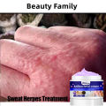 Antibacterial Cream Eczema Treatment Cream Atoderma Cream Original Fungisol Anti Fungal Cream Anti Itch Cream. 