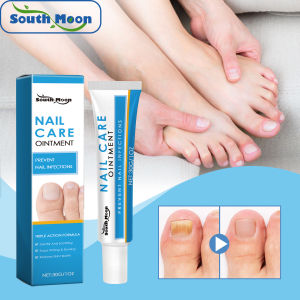 South Moon Nail Fungus Ointment Fungal Infection Nails Cream Feet Anti Removal Onychomycosis Paronychia Toe Repair Essence Cream Nail Fungus Treatment Serum Foot Repair Liquid Toe Nails Fungal Removal Gel Anti Infection Paronychia Onychomycosis Cream