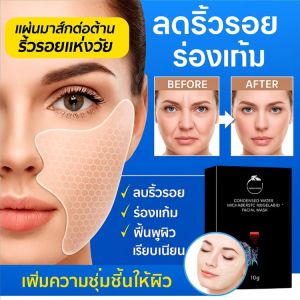 แผ่นแปะริ้วรอยร่องแก้มไมโครคริสตัล มาส์กร่องแก้ม ลดริ้วรอย ริ้วรอยร่องแก้มจาง ยกกระชับผิวหน้า