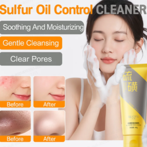💕Oil Control Cleanser💕Sulfur Oil Control Cleanser Cleansing Cleanser Deep Cleansing Acne Removal Hydration Locks in Moisture Without Tightening Sulfur Cleanser硫磺控油洁面乳