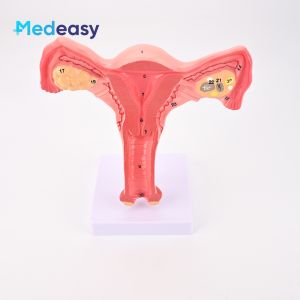 Female Uterine Anatomy Teaching Model Uterus Anatomical Model