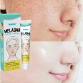 Sumifun Cream Penghilang Flek Hitam Whitening Freckle Cream Krim Bintik Melasma Mencerahkan Kulit Efektif Menghilangkan Bintik Hitam 20g. 