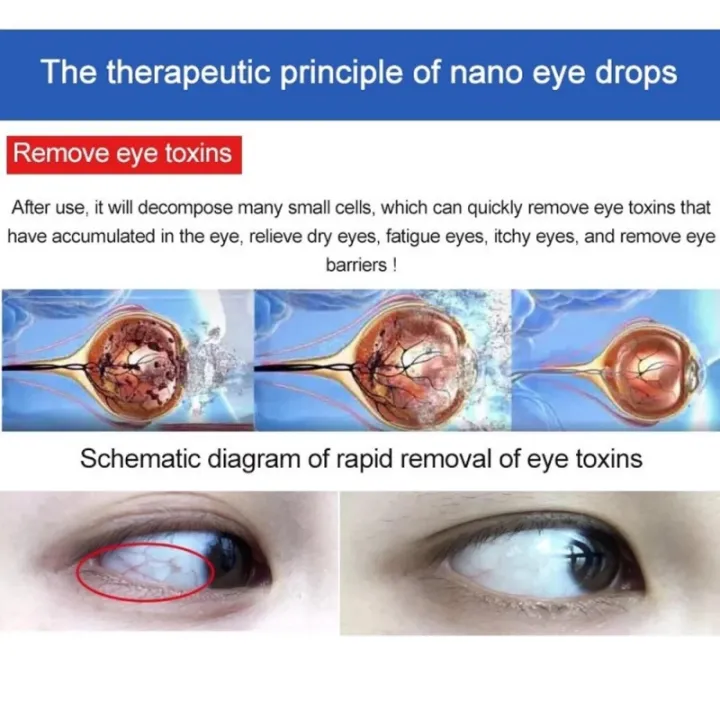 Japan%20Astigmatism%20Short-Sighted%20Eye%20Drops%20Dry%20Eye%20Relief%20Cure%20Sore%20Eyes%20And%20Blurred%20Vision%20Ubat%20Mata%20Rabun%20Ubat%20Mata%20Selaput%20Penawar%20Mata%20Eye%20Care%20Original%20%E7%9C%BC%E8%8D%AF%E6%B0%B4%20-%20Image%205