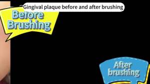 Kids Electric Toothbrush，Toddler Toothbrush Waterproof Battery Powered 360 Automatic Sonic u Shaped Toothbrushes for 2-7 Years Old for Boys Girls，with 2 Replacement Brush Heads（Blue）