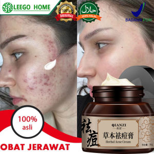 30g Obat jerawat dan bekas jerawat penghilang salep obat paling ampuh removal of acne cream untuk pria dan wanita menghilangkan dengan cepat Salep Krim Obat Paling Ampuh Mengatasi Jerawat Membandel Di Wajah/ Removal of Acne Cream