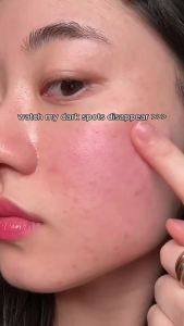 KOEC Transdermal Niacinamide Brightening Face Cream celmax Pore+Dark Spot Cream
