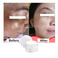 Penghilang Flek Hitam Paling Ampuh BPOM Salep Flek Hitam Ampuh Untuk Menghilangkan Flex Hitam Melasma Salep Flek Melasma Membandel Krim Penghilang Flek Hitam Di Wajah Permanen Cream Flek Khusus Flek Bandel Glowing Cream Leika Penghilang Flek Hitam Melasma. 