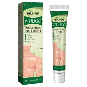 【Hot Sale】South Moon Vitligo Treatment Ointment White Spot Tag Remove Serum Cream Herbal Vitiligo Treatment Ointment Leukoplakia Ringworm Disease Reduces Repair Pigment Skin White Spot Vit-iligo Therapy Cream Ointment Antibacterial Cream Promot Liniment