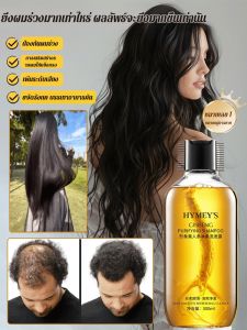 แชมพูขิง ป้องกันผมร่วง บำรุงผม เสริมสร้างผมให้แข็งแรง ควบคุมความมัน นุ่มสลวย ขจัดรังแค สำหรับผู้ชายและผู้หญิง 超强生发养发洗发水