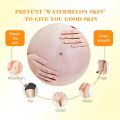 Stretch mark cream scar remover cream Stretch Marks Remover Skin Repair Cream 50g Special for Pregnancy Postpartum Care Remove pregnancy scars. 
