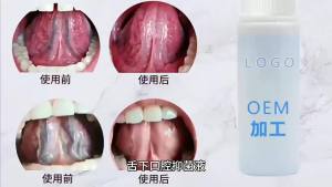 舌下排浊口腔抑菌液舌底清新喷剂植物提取喷剂源头厂家消字号加工