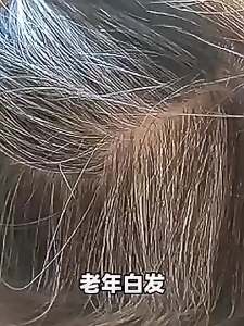 何首乌白转黑精华液白发转黑发营养液防脱发育发液乌黑养发黑发液