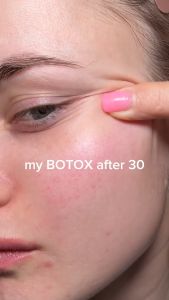 Kem chống lão hóa trẻ hóa da CENTELLIAN 24 Madeca Cream Time Reverse 50ml