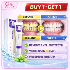 🌟 BUY 1 TAKE 2 - Whitening Toothpaste 100g 🌟Sally Beauty Toothpaste Whitening Yellow Teeth Remover Freshens Breath 14 Days Before After Comparison