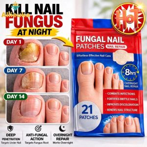 Allieuka Toenail Fungus Treatment Patches Hydrogel Nail Repair Patch Overnight Care for Damaged Nails 21 Pcs