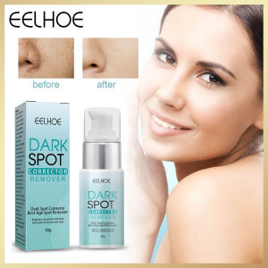 High Quality 【 Spot inventory 】Eelhoe Dark Spot Remover Fade Cream Corrector  for Melasm玩具a Reduces Age Spots Whitening Freckle Cream Remove Dark Spots Melanin Even Skin Tone Dark Spot Corrector Skin Whitening Moisturizing Cream（30g）