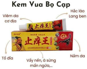 Kem thảo mộc ông già Nấm Ngứa Lang Ben Hiệu Quả/giảm sừng &nấm da đầu